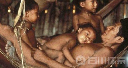 实拍印尼女孩割礼全过程  阴蒂被全部剔除残忍至极