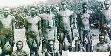 揭秘非洲巨蛋族的男人睾丸形成原因