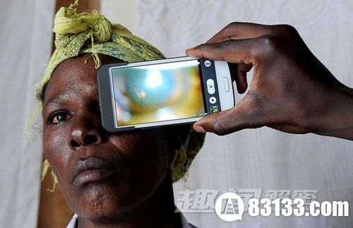 基于智能手机的眼疾检测技术