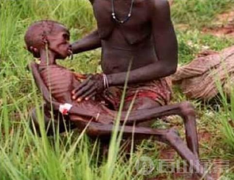 在非洲饥荒中快饿死的孩子