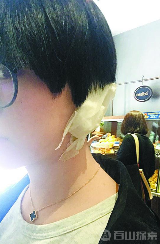 女子理发被剪耳垂，店员表示“剪掉耳朵很正常”